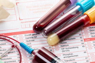 Клинические исследования крови